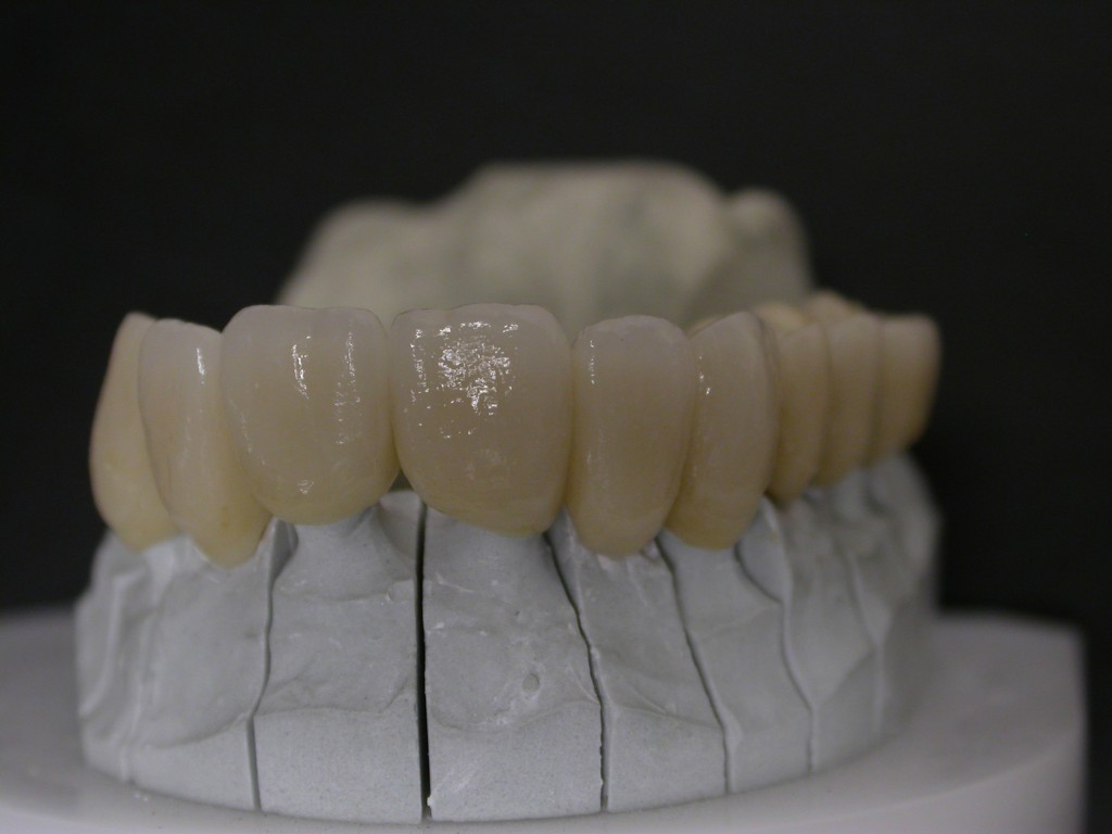 Armatures zircones