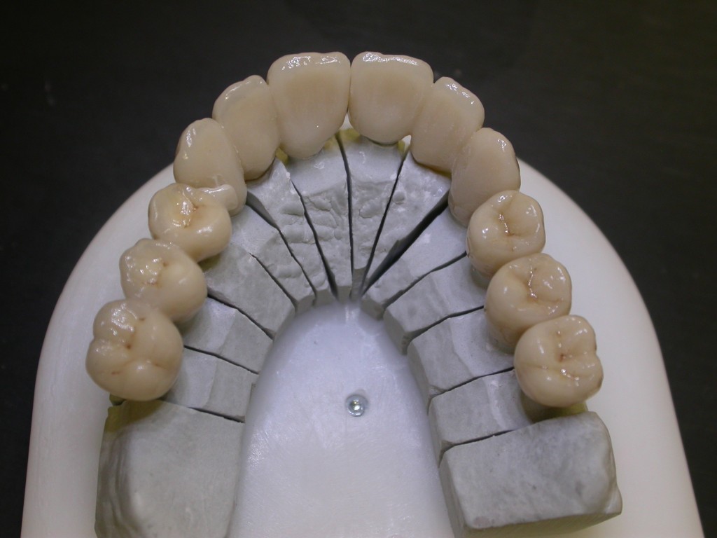 Armatures zircones
