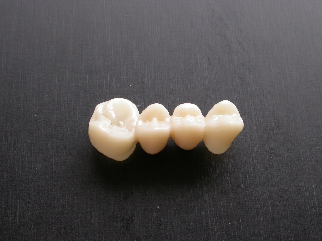 Armatures zircones