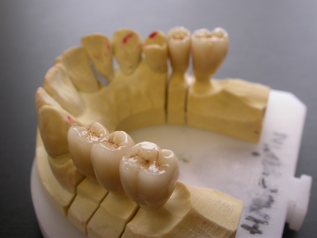 Armatures zircones
