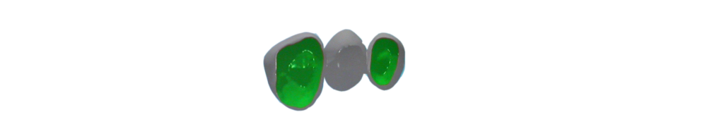 synthese1